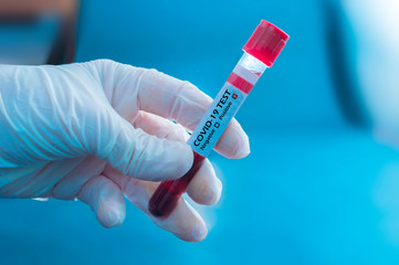 Naklejka premium Doctor's hand holds blood sample that gives positive result in the covid-19 coronavirus test. Covid-19 test. Blood sample. Biological risk.