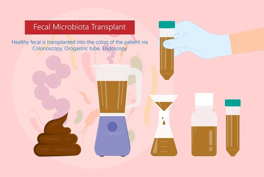 Fecal microbiota transplant (FMT) stool transferring bacteria microbes 
