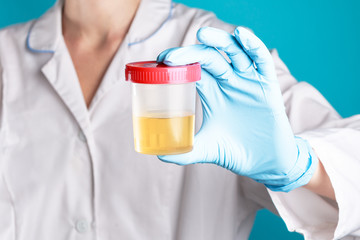 doctor in a white uniform and blue gloves on a blue background holds a plastic test jar with yellow urine. test for disease