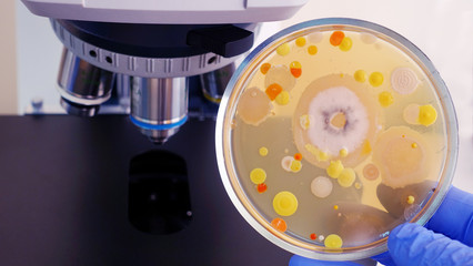 A Petri dish with colored bacteria on the background of the microscope. Bacterial analysis in the...