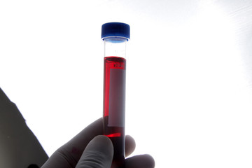 Blood sample from patient placed into test tube for analyzing and testing at laboratoty