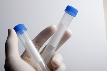 Close up shot of empty plastic test tube with blue lid for medical and laboratory testing purpose