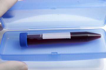 Blood sample from patient placed into test tube for analyzing and testing at laboratoty