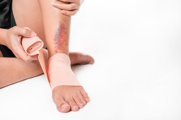 Asian women have bruise on leg from accident and use elastic bandage on her leg, on white...
