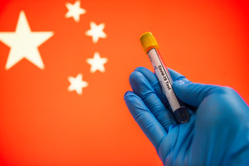 Coronavirus or Covid-19 in China, , sample blood tubes in hand Chinese flag on background, Blood sample with COVID-19 Coronavirus Chinese infection China