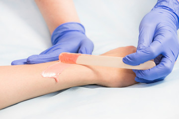 The process of laser depilation of female limbs in the beauty salon. 