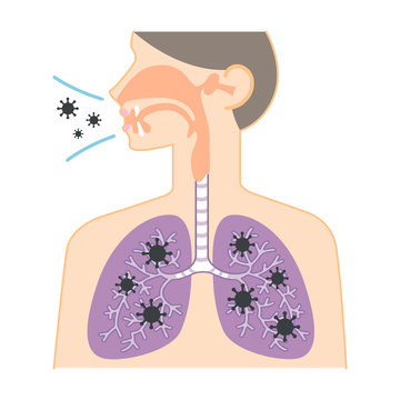 鼻・喉・肺の図表（ウイルスの侵入）