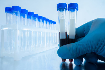 Lab technician holds test tubes for analysis. General blood analysis. Taking blood from infected...