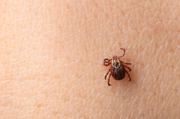 mite on the skin of a person close-up. Concept of the season for the spread of ticks and diseases transmitted through insect bites.
