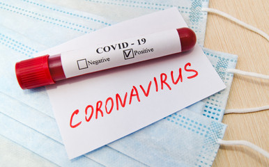 Obraz premium Coronavirus blood test concept. Test tube with coronavirus positive blood over laboratory desk