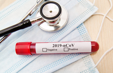 Coronavirus blood test concept.  Test tube with coronavirus positive blood over laboratory desk