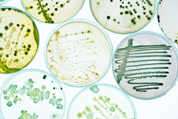 Growing Bacteria in Petri Dishes on agar gel Scientific experiment.