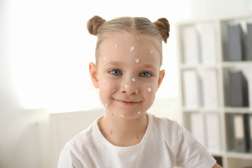 Little girl with chickenpox in clinic. Varicella zoster virus