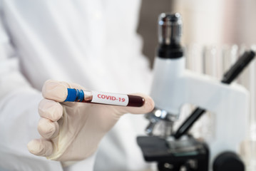 Nurse holding test tube with blood for nCoV-2019 analyzing, coronavirus test concept in laboratory
