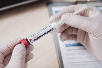 Naklejka premium Doctor with a modern tube of biological sample contaminated by Coronavirus. Technician making medical exam in the laboratory. Specialist fills the medical form after taking blood from the patient. 