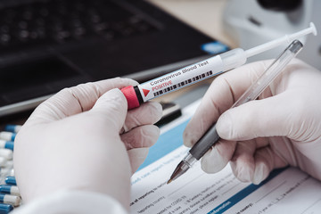 Doctor filling form after coronavirus test. Analysis of test tube with a sample. Tube of biological sample contaminated by Coronavirus in hand wearing a silicone glove. Positive results. Medical exam.