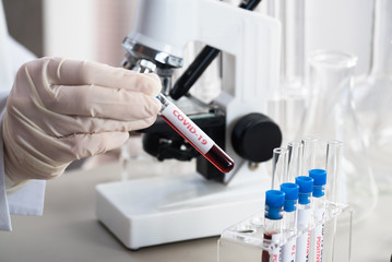 Fototapeta premium Nurse holding test tube with blood for nCoV-2019 analyzing, coronavirus test concept in laboratory
