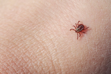 dangerous insect mite crawls on human skin causing various infectious disease