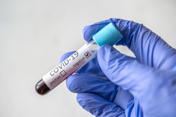 Coronavirus testing