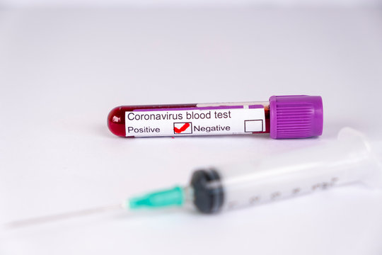 Positive blood test result for the new rapidly spreading Coronavirus, originating in Wuhan, China
