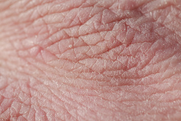 background with the texture of pink weathered human hand skin covered with deep wrinkles and dry...