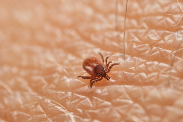 Tick (Ixodes ricinus) on skin. Dangerous mite, can cause Lyme disease (borreliosis), tick-borne encephalitis and ehrlichiosis. Europe, Czech Republic