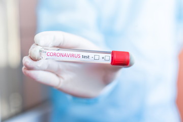 Fototapeta premium Hand holding a test tube with the inscription coronavirus test + - in front of him on a blurry background close-up