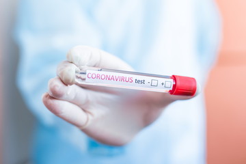 Hand holding a test tube with the inscription coronavirus test + - in front of him on a blurry background