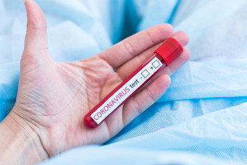 Hand holding a test tube labeled coronavirus test + - with a sample of the patient's blood COVID-19