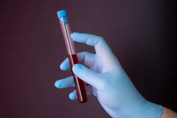 A doctor in disposable latex gloves holds a test tube with a blood sample.
