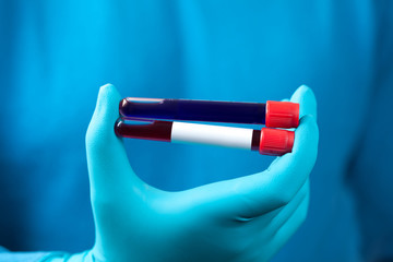Coronavirus 2019-nCoV Blood Sample.