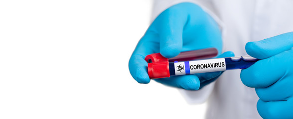 Coronavirus 2019-nCoV Blood Sample.