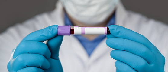 Coronavirus 2019-nCoV Blood Sample.