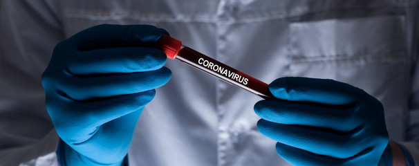 Coronavirus 2019-nCoV Blood Sample.
