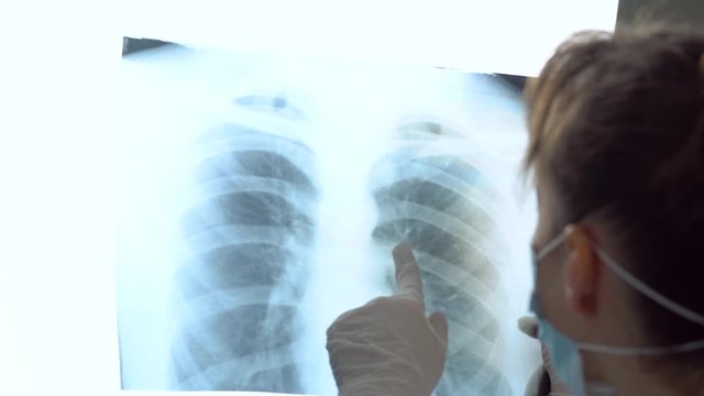 Young caucasian doctor in protective mask examine x-ray of lungs, holding it in hands indoors. Specialist hold transparent image of chest in arms, and carefully researches it for coronavirus