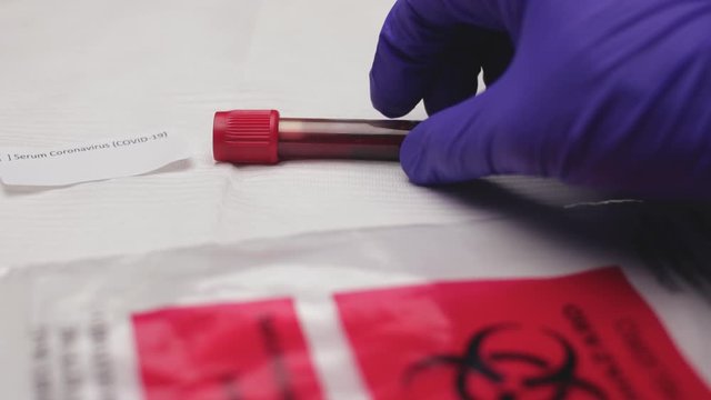 Nurse places blood test tube on table next to coronavirus specimen label, biohazard bag in foreground. Slow motion, shot 60 fps