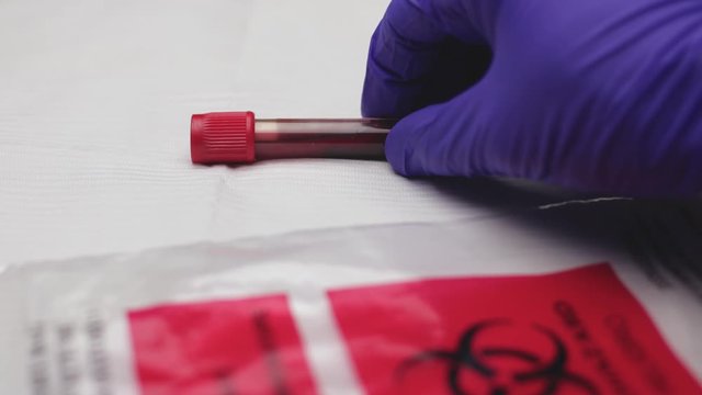Nurse places red blood test tube sample on table, ready for diagnostic analysis test, biohazard bag in foreground. Slow motion, shot 60 fps