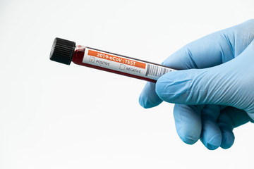 Fototapeta premium Test tube with blood sample in lab for COVID-19 test in hand of doctor wear blue glove, laboratory sample of blood testing for diagnosis new Corona virus infection, the pandemic infectious concept
