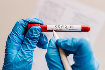 Coronavirus. A hands of doctor, nurse writing a note with a pen, holds tube containing a...