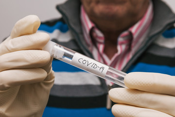 Gloved man holding a test tube to take samples with a coronavirus label. Rapidly spreading coronavirus, native to Wuhan, China. Selective focus.