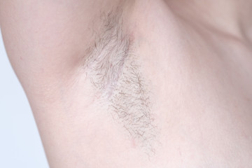 Young woman showing hairy armpit on white background, closeup. Epilation procedure