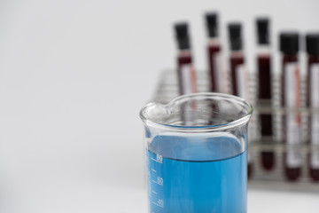 Methylene blue test liquid with blood sample for test, laboratory sample of blood testing for diagnosis virus infection, the pandemic infectious concept