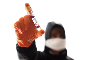 Corona virus. Sars-Co-2. Sars - 19th SARS-CoV-2. Infection test.