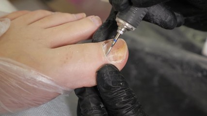 Hardware pedicure in the salon. The master processes the damaged nail. Close-up.