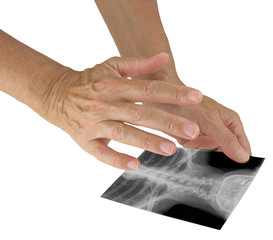 Sending distant healing to woman via photograph of X-ray - holding a black and white photo of a...