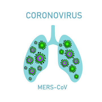 MERS-CoV (Middle Eastern Coronavirus Respiratory Syndrome) Image Illustration - Stock Vector