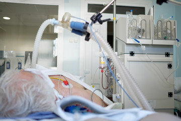 Patient with coronavirus pneumonia in critical state. Intubated senior under ventilator lying in...