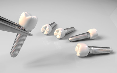 Dental implants with tweezers and white background illustration