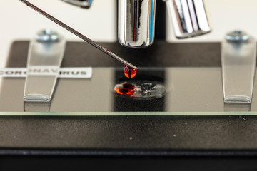 blood sample placed on a microscope slide