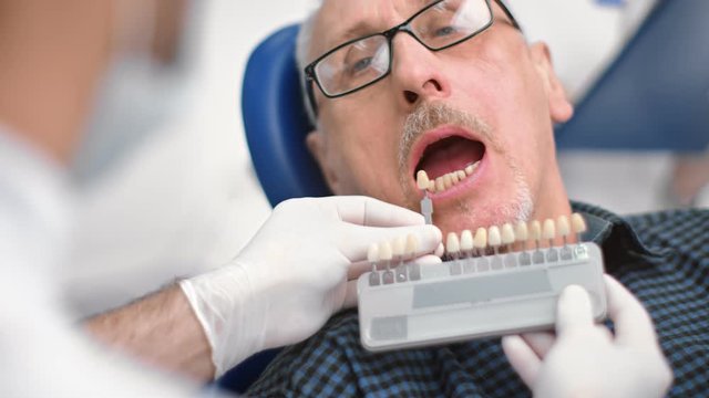 Close up senior patient with open mouth during comparing color enamel. 4k Dragon RED camera